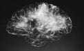 Brain Building neurotech community in Alberta earns student startup award